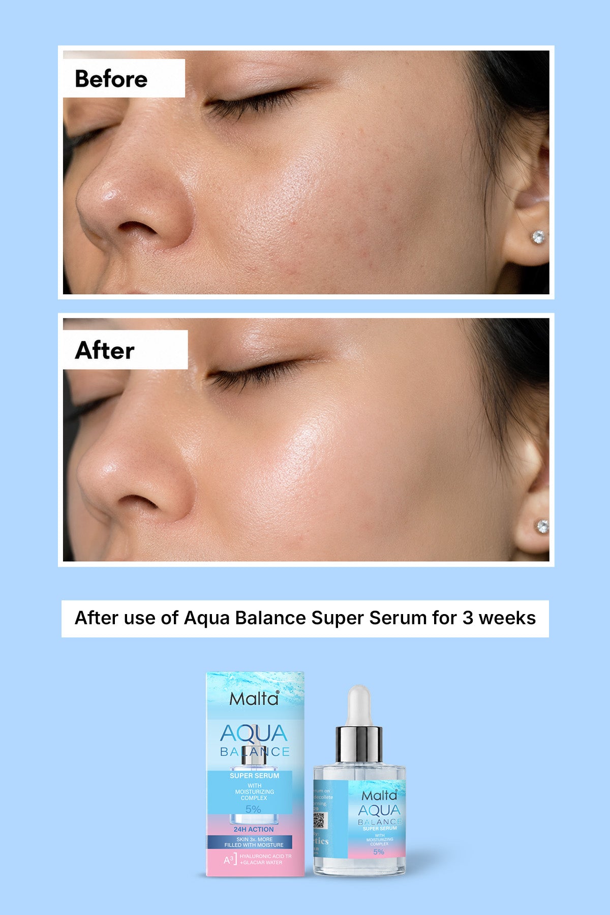 Aqua Super Serum