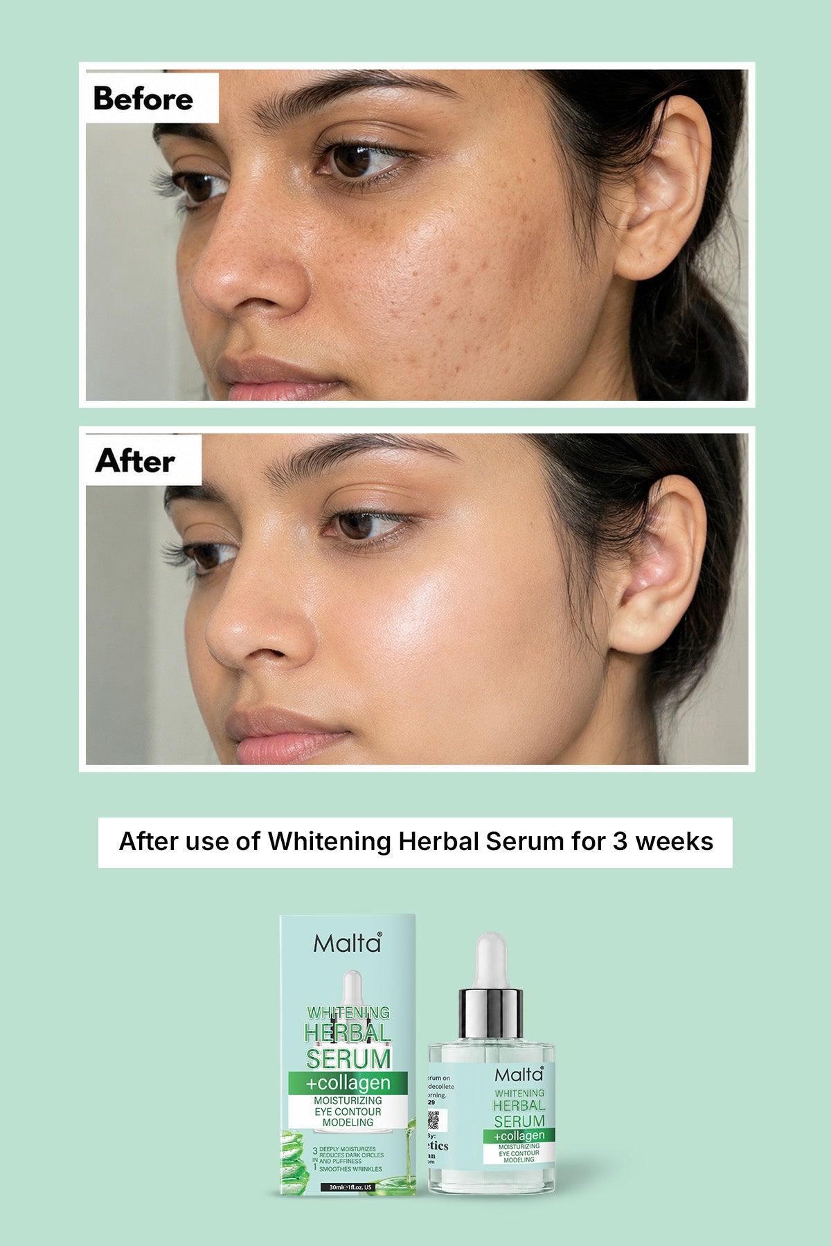 Malta Herbal Serum