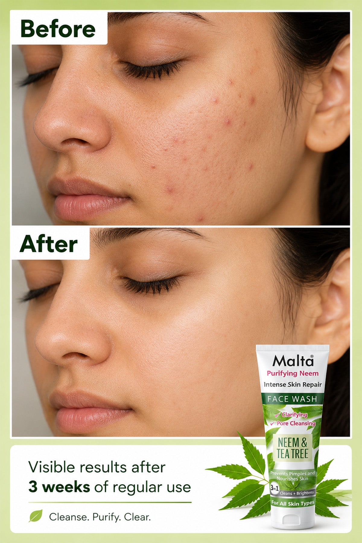 Malta Neem & Tea Tree Face Wash