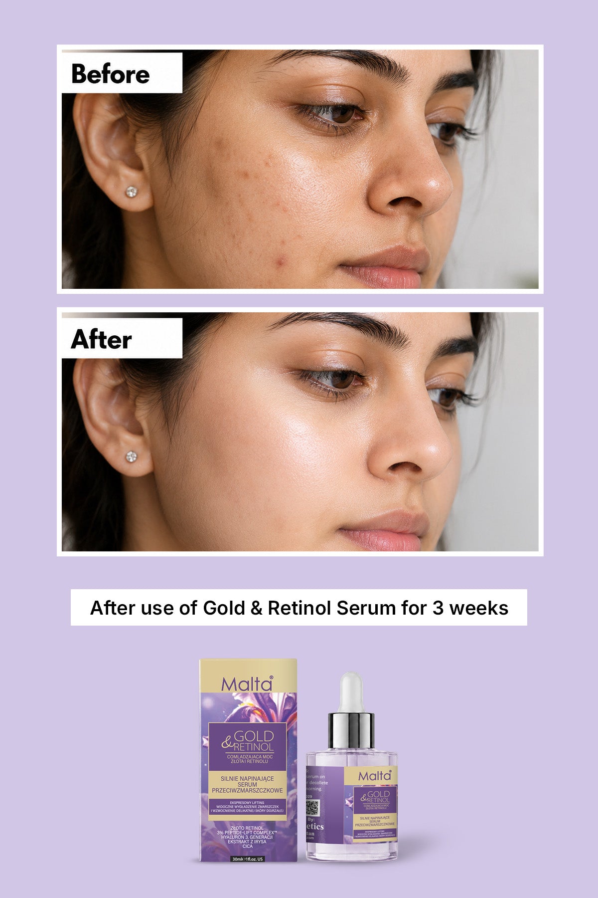 Retinol Serum