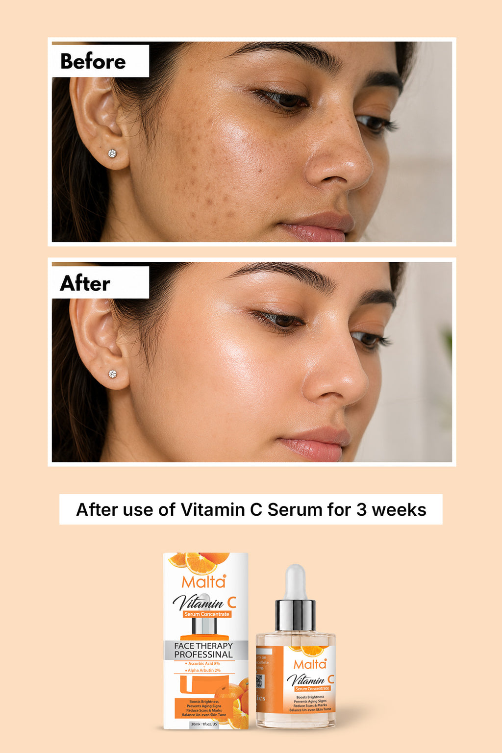 Malta Vitaman C Serum