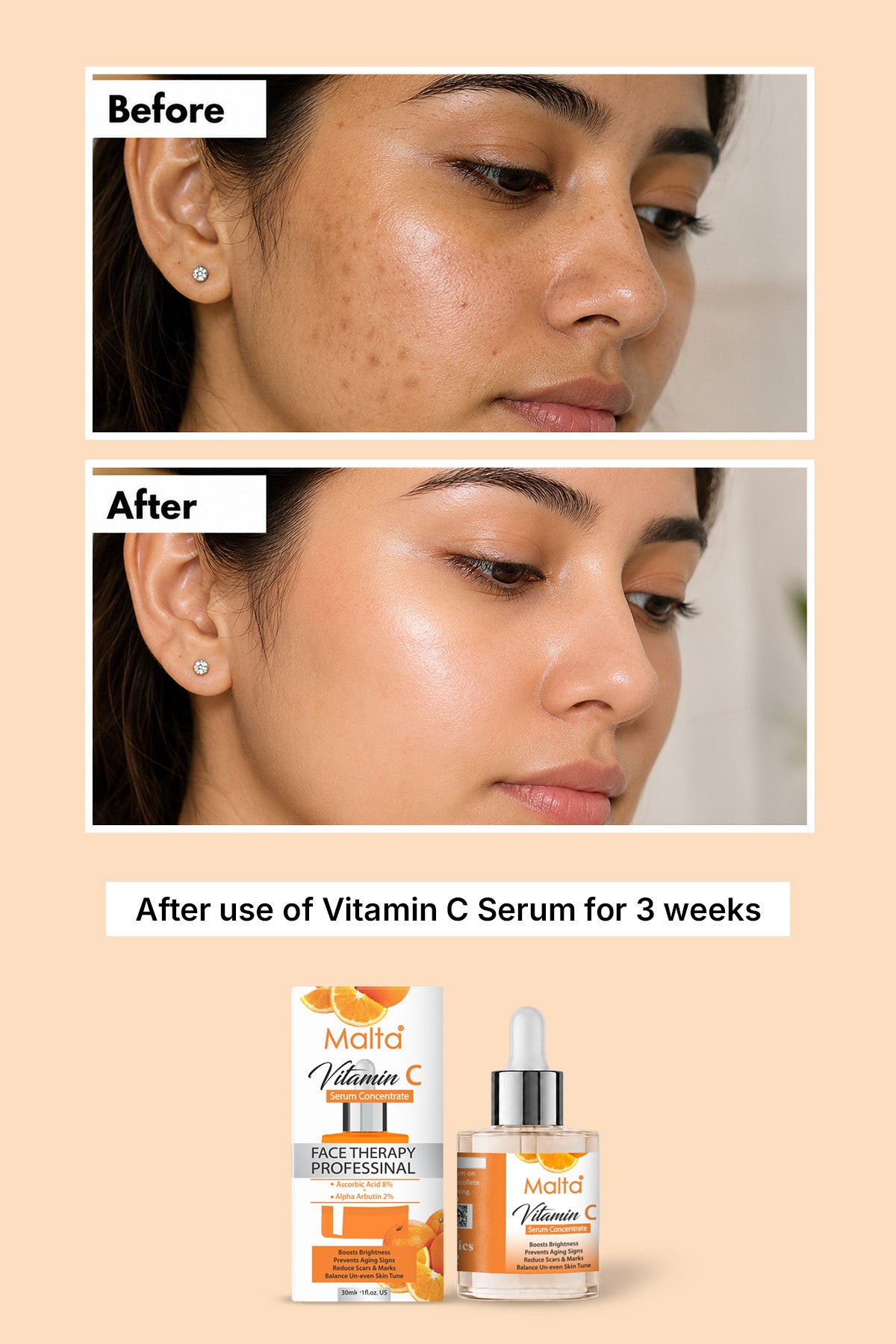 Malta Vitaman C Serum